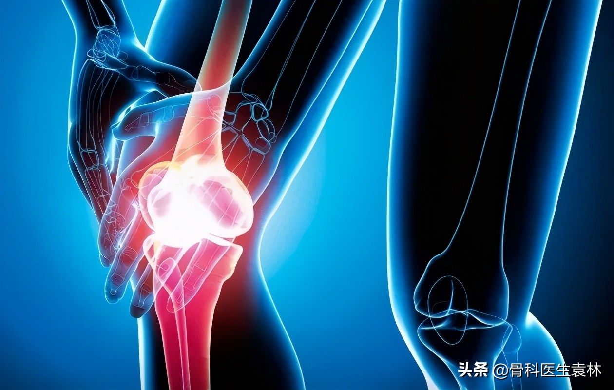 什么是髌骨软化最佳治疗方法,髌骨软化症最好治的办法是什么