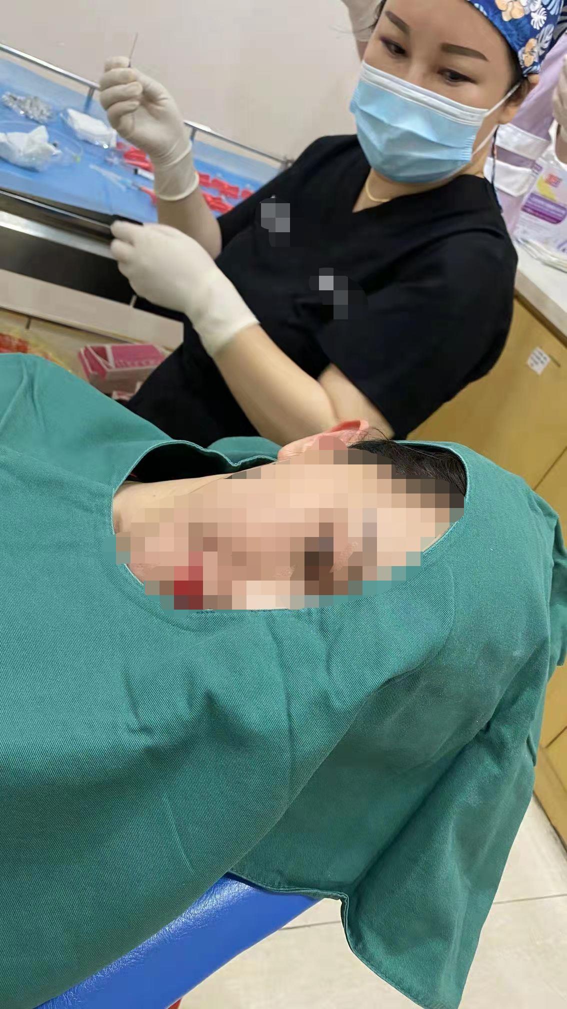 抽脂会有很大危险吗,抽脂可不可怕