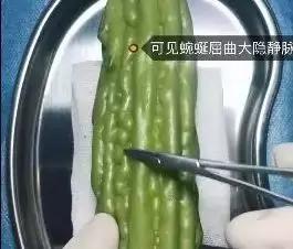 香蕉割包皮,洋葱剖腹产?这是我见过最秀的医生