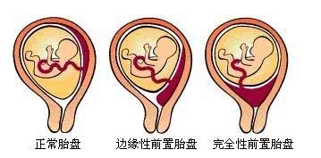 做过人流老公会发现吗,瞒着男朋友做了人流