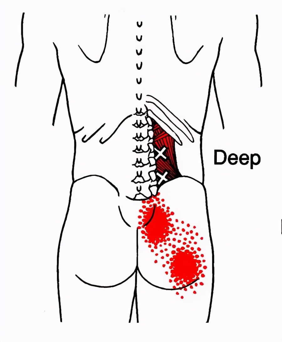 康复训练手法干货分享,康复治疗师肌肉