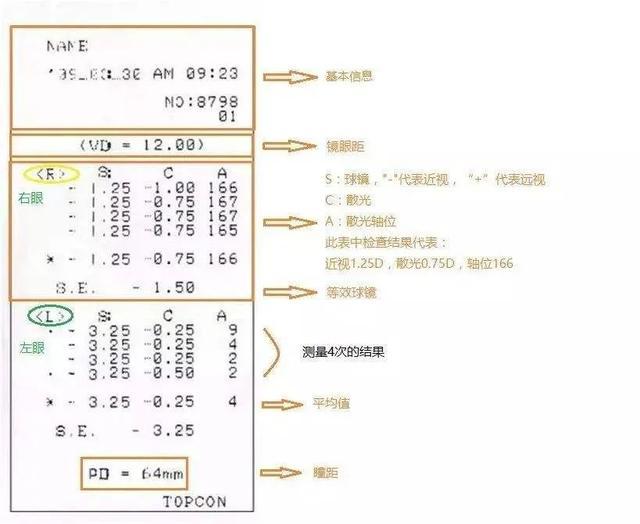 电脑验光和人工验光哪个准确,眼镜店电脑验光准确吗