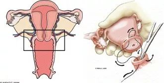 听专家说老年肿瘤怎么治,专家讲癌症