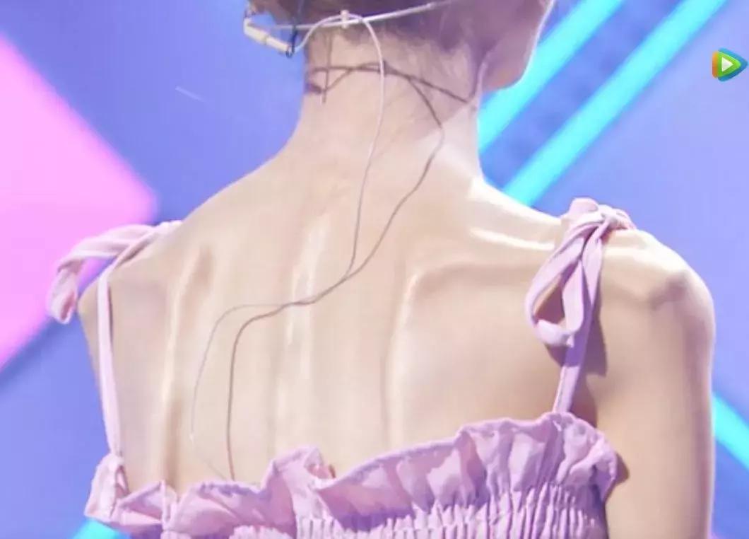 自杀式减肥到58斤:你和ICU,不过一念之隔