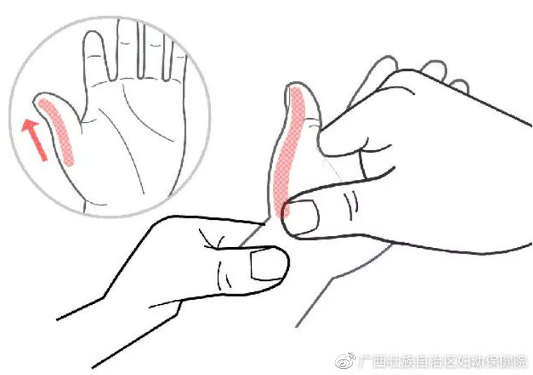 宝宝大拇指一直内扣怎么纠正过来,宝宝拇指内扣最严重的结果是什么