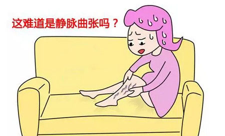 预防静脉曲张八点注意事项,预防静脉曲张的几个动作