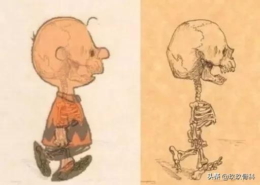 小孩会得骨质疏松症吗,儿童骨质疏松的症状有哪些