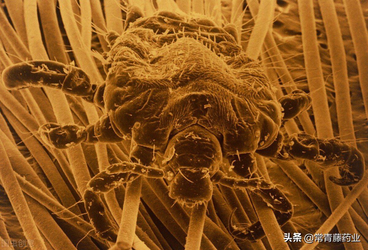 如何判断阴虱病彻底治愈,你知道阴虱哪里来的