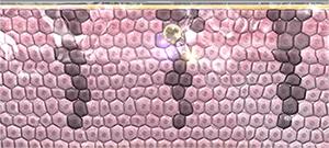 祛色斑的小窍门,色斑严重学会这几招省钱又有效