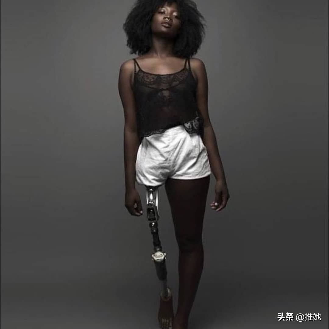 6岁被截肢，20岁被网暴，女孩儿鼓足勇气成为内衣模特