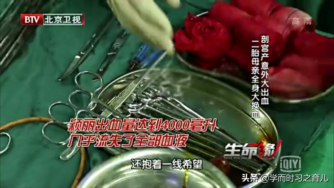 孕早期怎么知道是前置胎盘,孕早期能看出前置胎盘吗