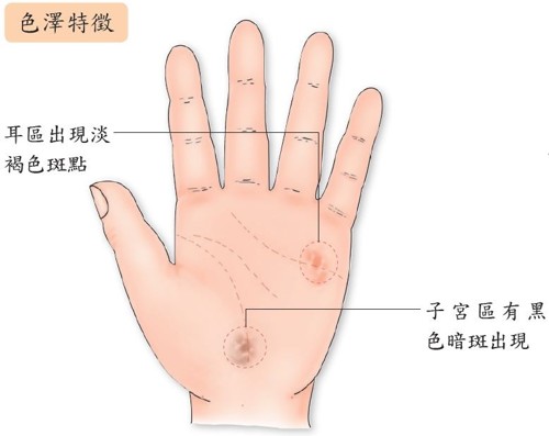 手诊子宫肌瘤手部反射区,大拇指上的穴位治子宫肌瘤