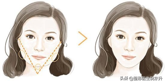 打瘦脸针和玻尿酸哪个伤害大,玻尿酸和瘦脸针打多了有啥坏处