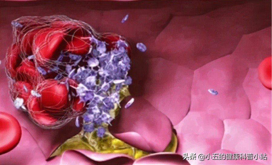 润肠通便茶,润肠茶与肠清茶有什么区别