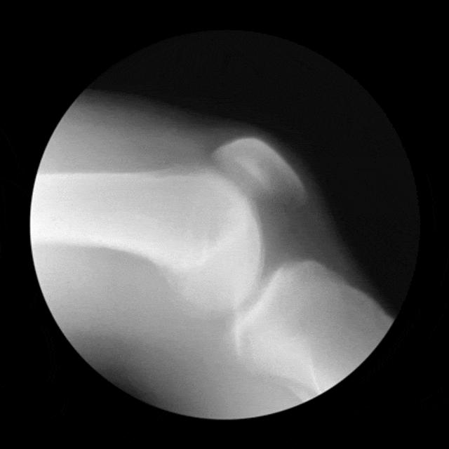 饴糖补脾,饴糖滋阴润燥