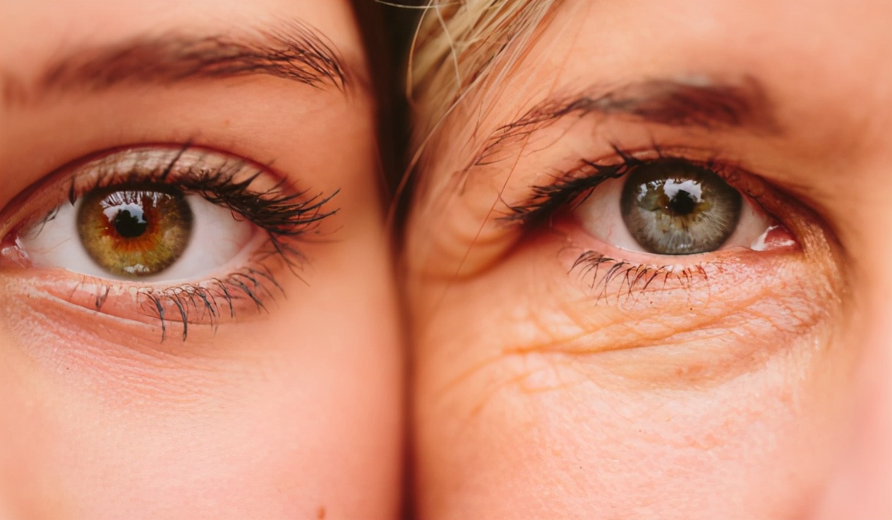 胖子减肥后皮肤松弛自己会修复吗,减肥皮肤松弛怎样让皮肤变紧致