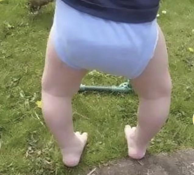 孩子走路“内八”or“外八”，可能和这3个小习惯有关