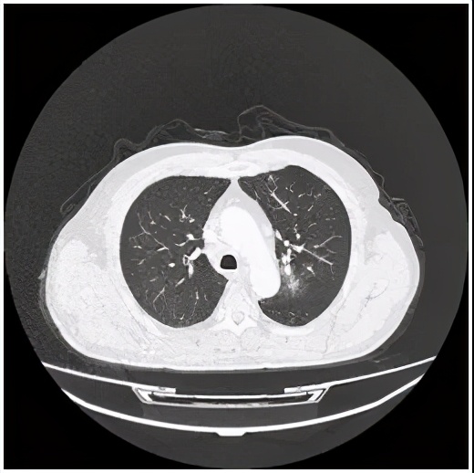 奇迹再现治愈版,医学奇迹再现视频