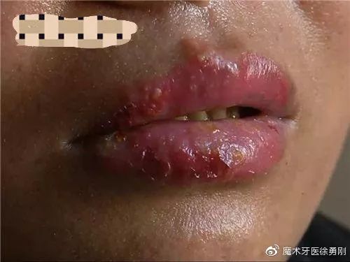内行人为什么不建议漂唇,作为一名医生一直被人质疑