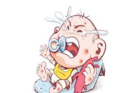 宝宝出水痘应该注意哪些事项,成人出水痘应该注意什么事项