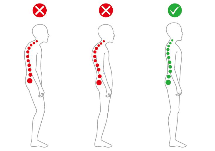 含胸驼背脖子前倾如何改善正骨,脖子前倾驼背最快纠正法