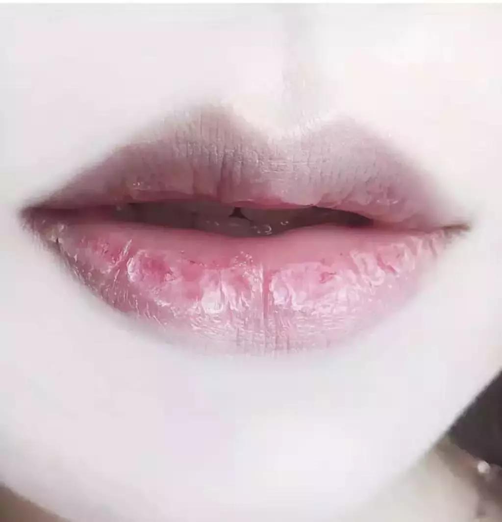 适合唇炎的唇膜测评红黑榜,干唇星人的救命唇膜视频