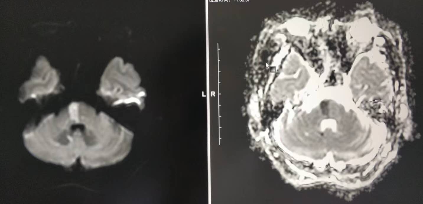 敬畏生命敬畏爱——沈阳市第九人民医院放射科服务患者马上到