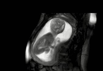 宝宝拳打脚踢胎动图,宝宝胎动用力是要告诉妈妈什么