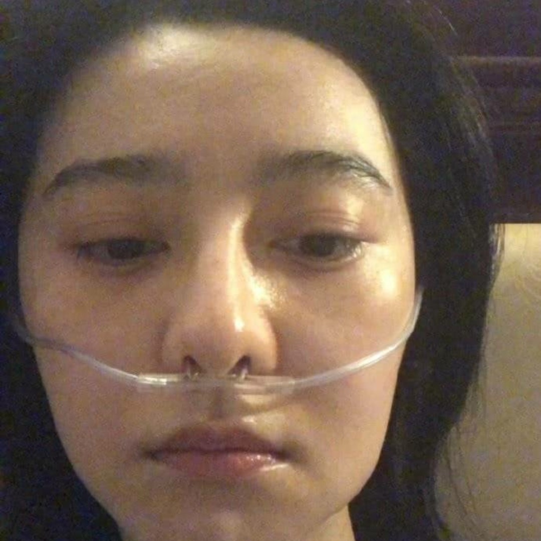 范冰冰高原反应照片,范冰冰李晨高原反应