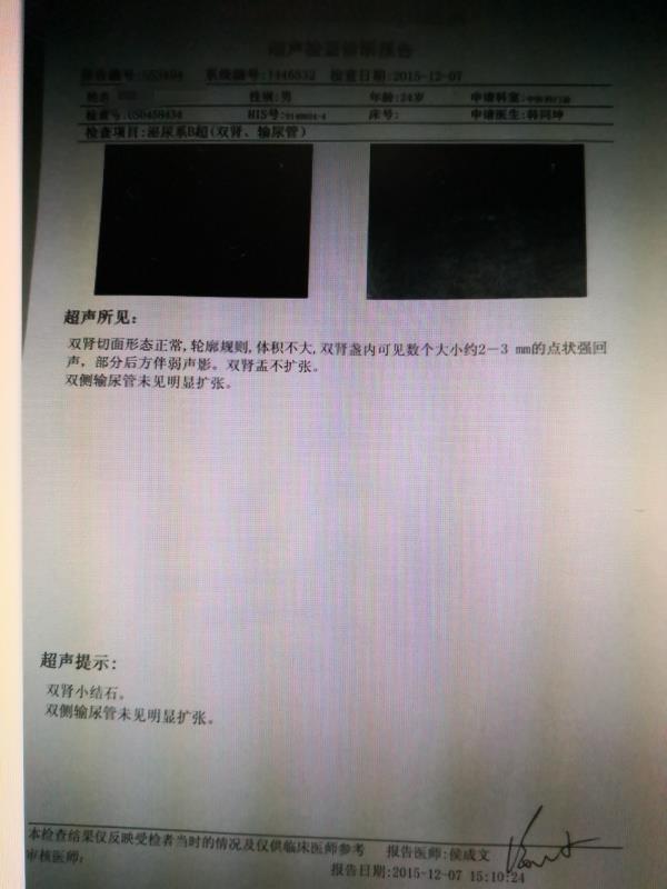 尿道结石疼痛打针能管多久,尿路结石打止痛针多久有效