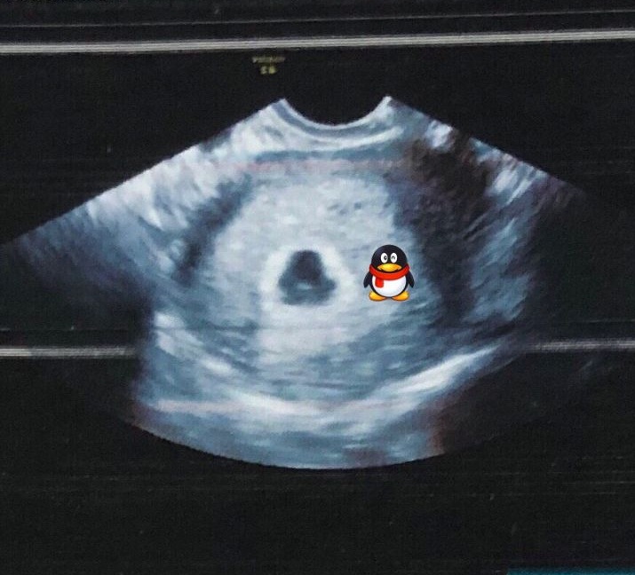 起名字大全2022年虎宝宝男孩小名,男孩名字大全2021属牛洋气小名