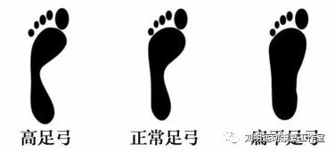 跑步是高级运动么,跑步真的有技术吗