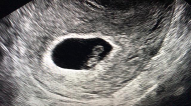 漳州试管婴儿医院3代,漳州市医院试管婴儿成功率