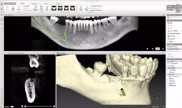牙齿公益广告,2021年缺失牙公益援助行动