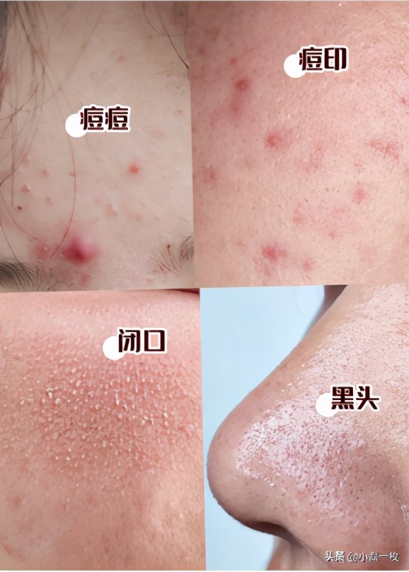 男士护肤哪一个好用又简单,男的用的最简单的护肤单品