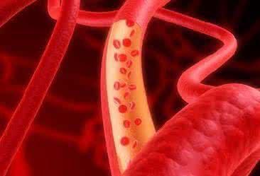 一代重生|氦氖雷射—血液垃圾清洁工无痛见效快