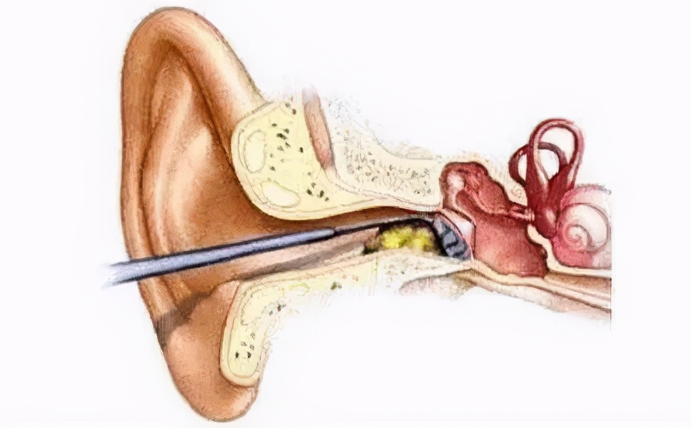 耳朵里面油油的湿湿的,耳朵里面油油的是膜吗