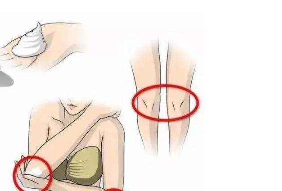 胳膊肘和膝盖黑怎么变白,手臂膝盖处黑要怎么美白