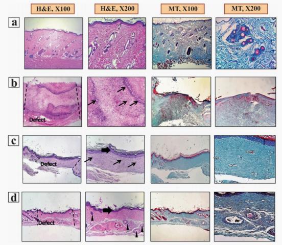 醋酸纤维医用抗粘敷料,纳米纤维伤口敷料