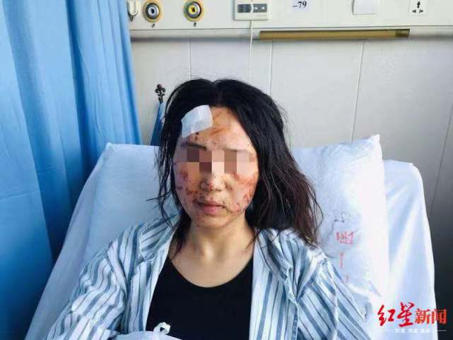 温州一女子遭公公和丈夫暴打新闻,温州女子遭暴打后续