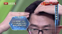 改善头发掉发最有效的方法,头发掉发最好的解决方法