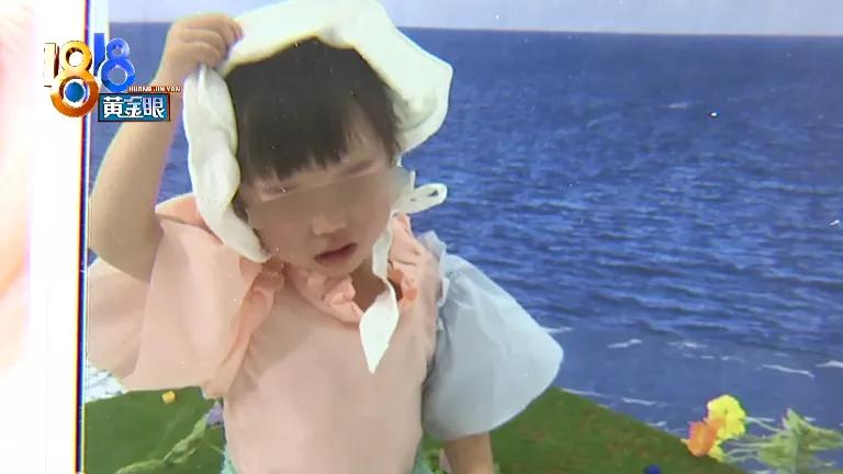 化妆品过敏小孩,孩子化妆过敏起疹子