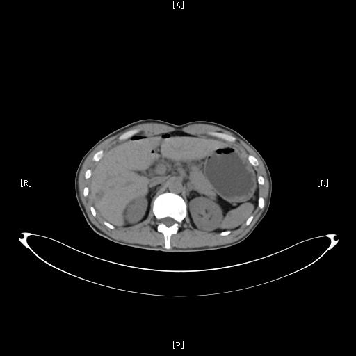 中右上腹疼痛有哪些病因,右上腹反复隐痛却查不出病因