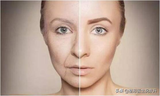 脸部皮肤松弛可以做啥手术改善,治疗脸部皮肤松弛无光泽的方法