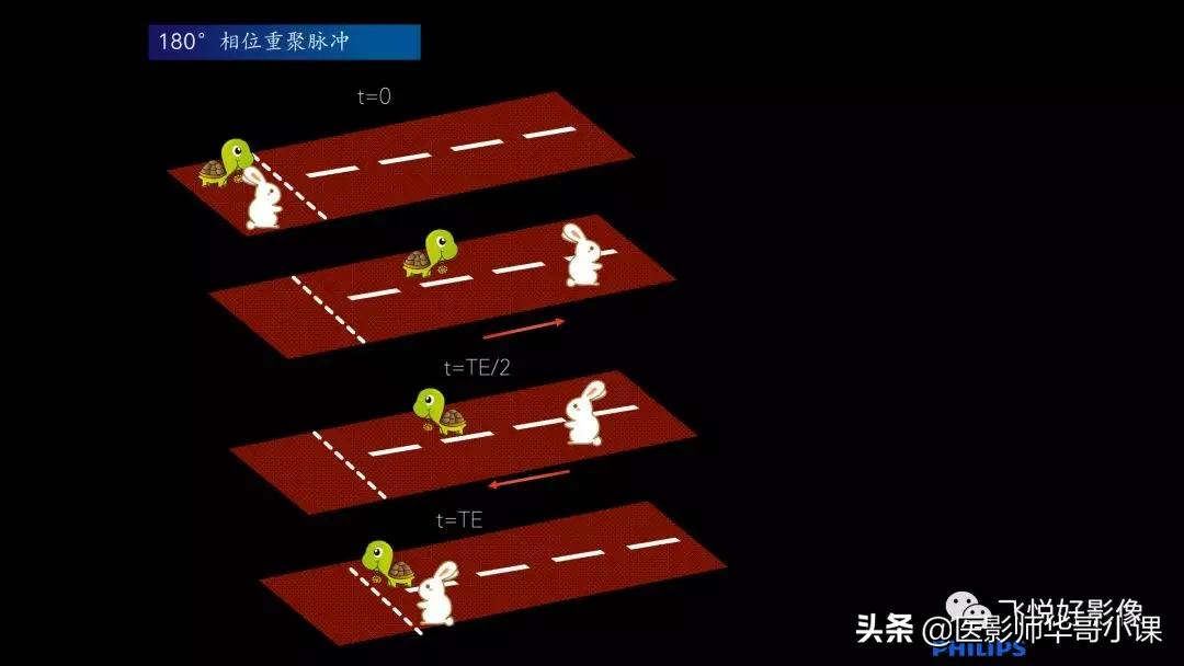 飞利浦磁共振图像操作,飞利浦磁共振成像序列及应用