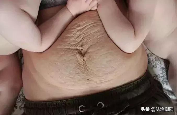 女明星自曝生儿子后“尿*禁失**”