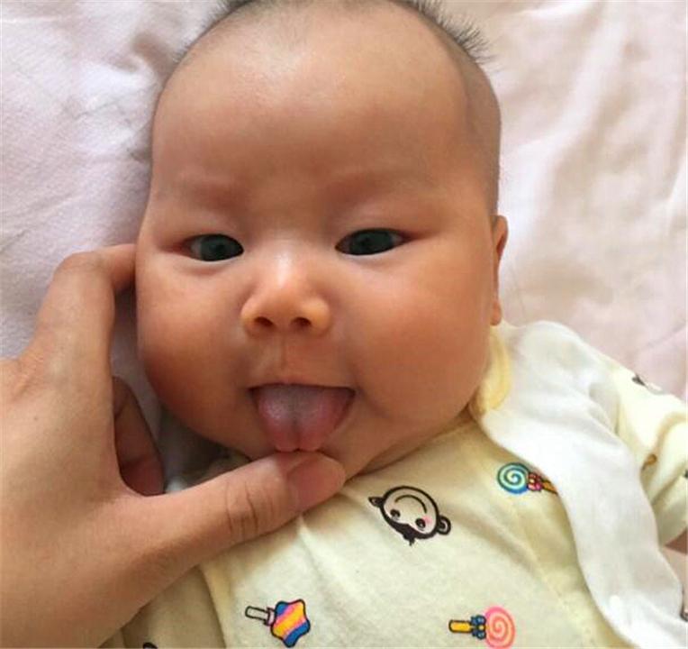 三岁孩子说话不清楚是舌系带短吗,宝宝舌系带短影响说话吗