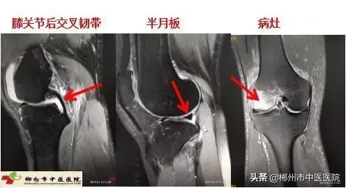 磁共振检查对身体有害吗,医院磁共振是检查什么的