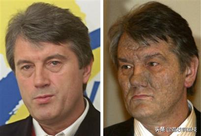 22岁可以开始初抗老吗,22岁女生怎么开始初期抗老