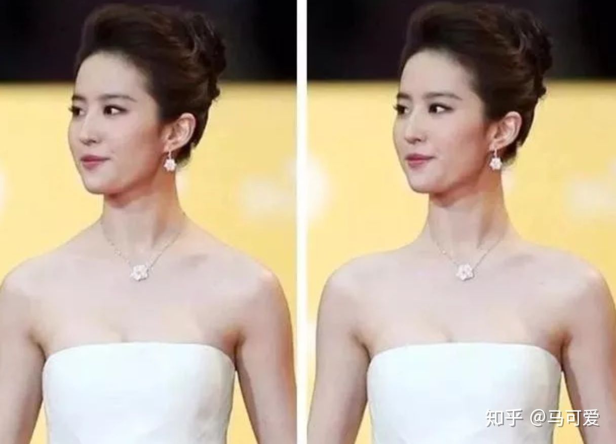 lisa的肩膀是直角肩吗,lisa的直角肩给她带来什么病